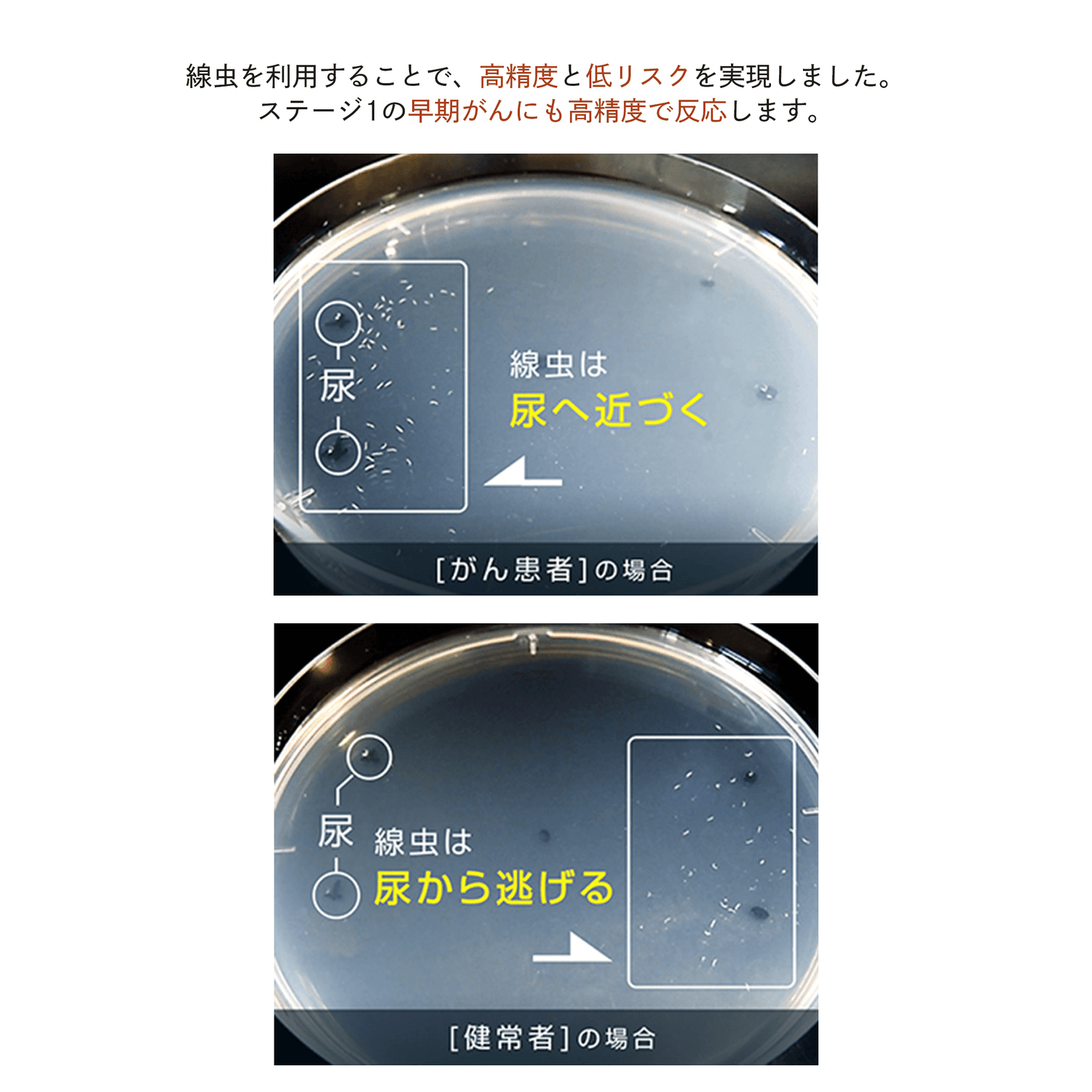 N-NOSE がんリスク検査薬 自宅で尿を採るだけ がんリスク検査 線虫 N-NOSE がん検査キット